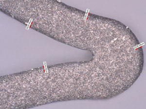 Stent surface (500x) after 100-micron glass bead followed by 17.5-micron aluminum oxide.